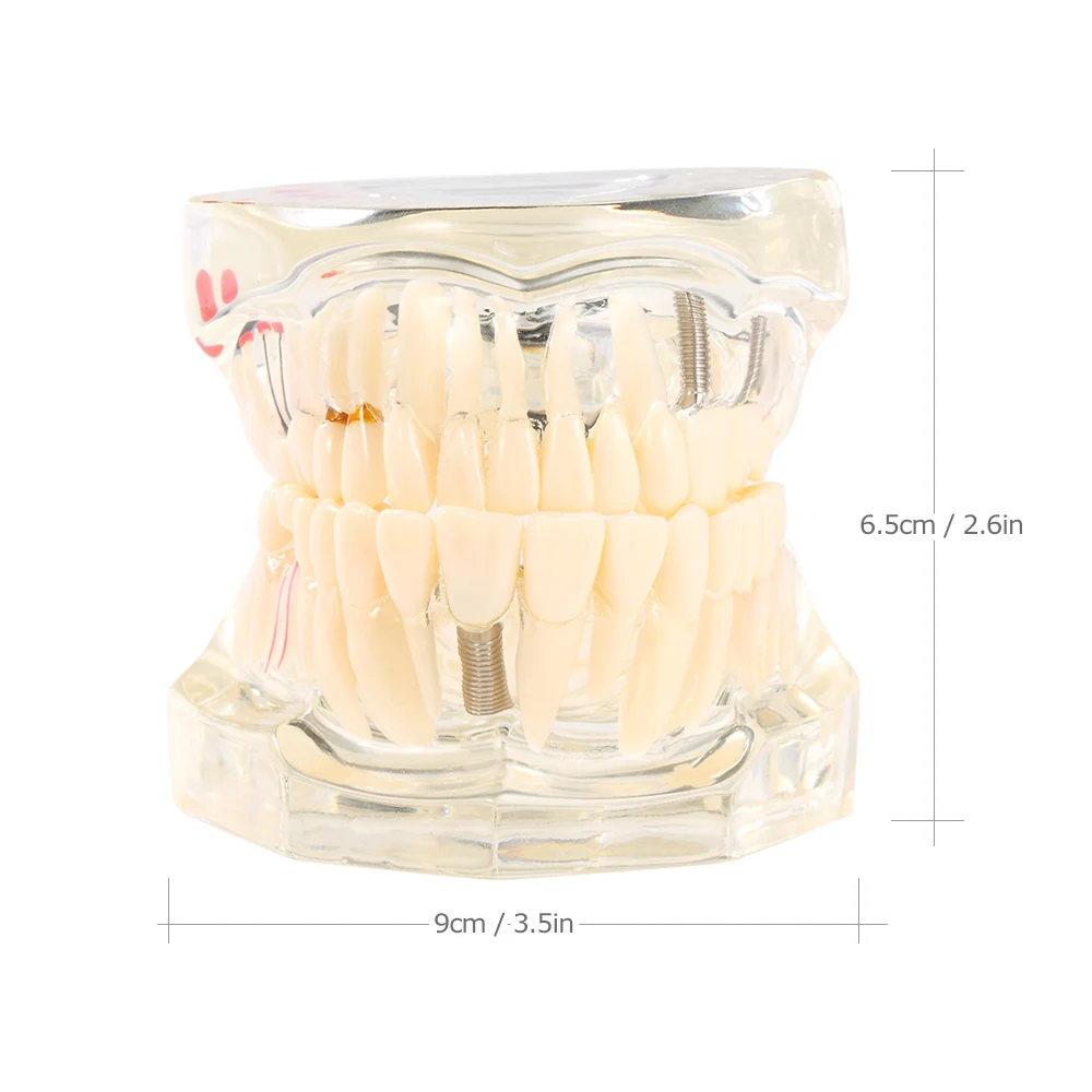Dentalmodelle reparierbare Harzmodelle für erkrankten Zähne für den – Bild 3